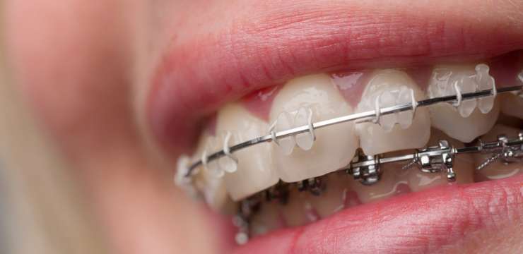 dentalcom-ortodonzia
